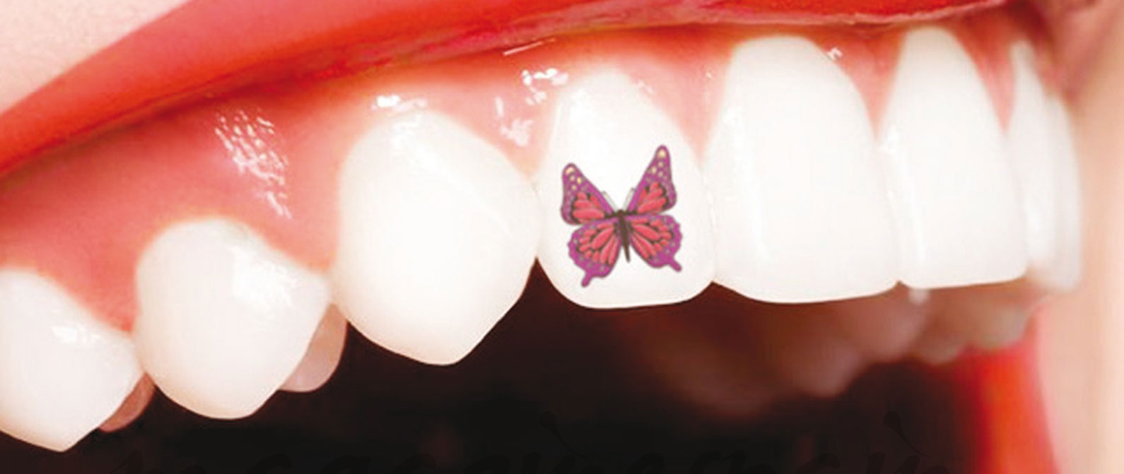 Tatuaje dental