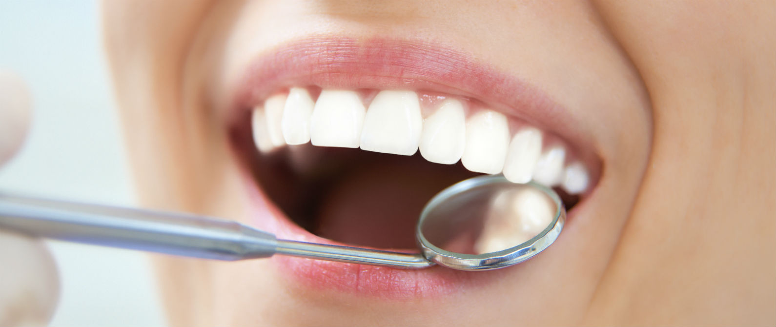 ¿Qué es una limpieza dental ultrasónica?