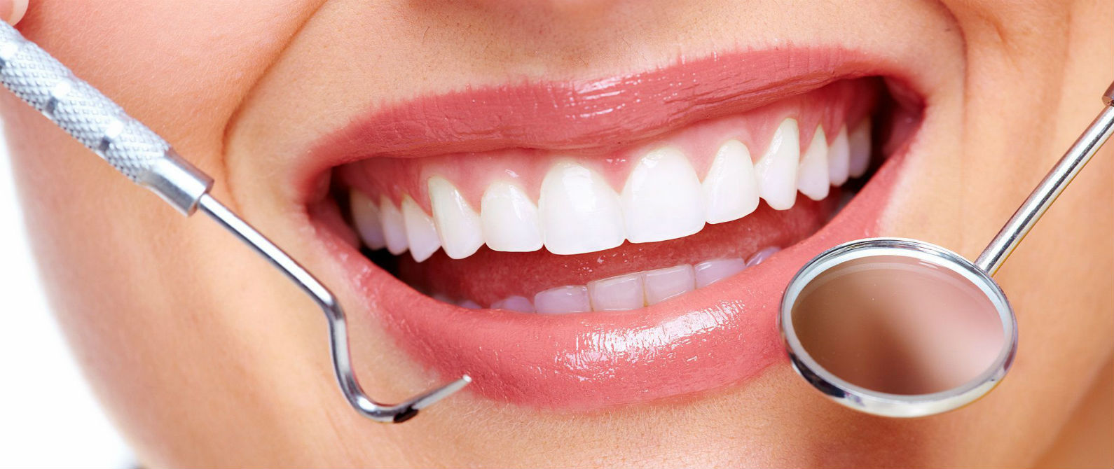 Blanqueamiento de dientes