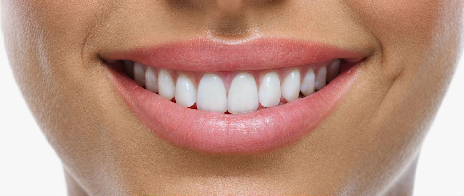 Beneficios de las carillas dentales