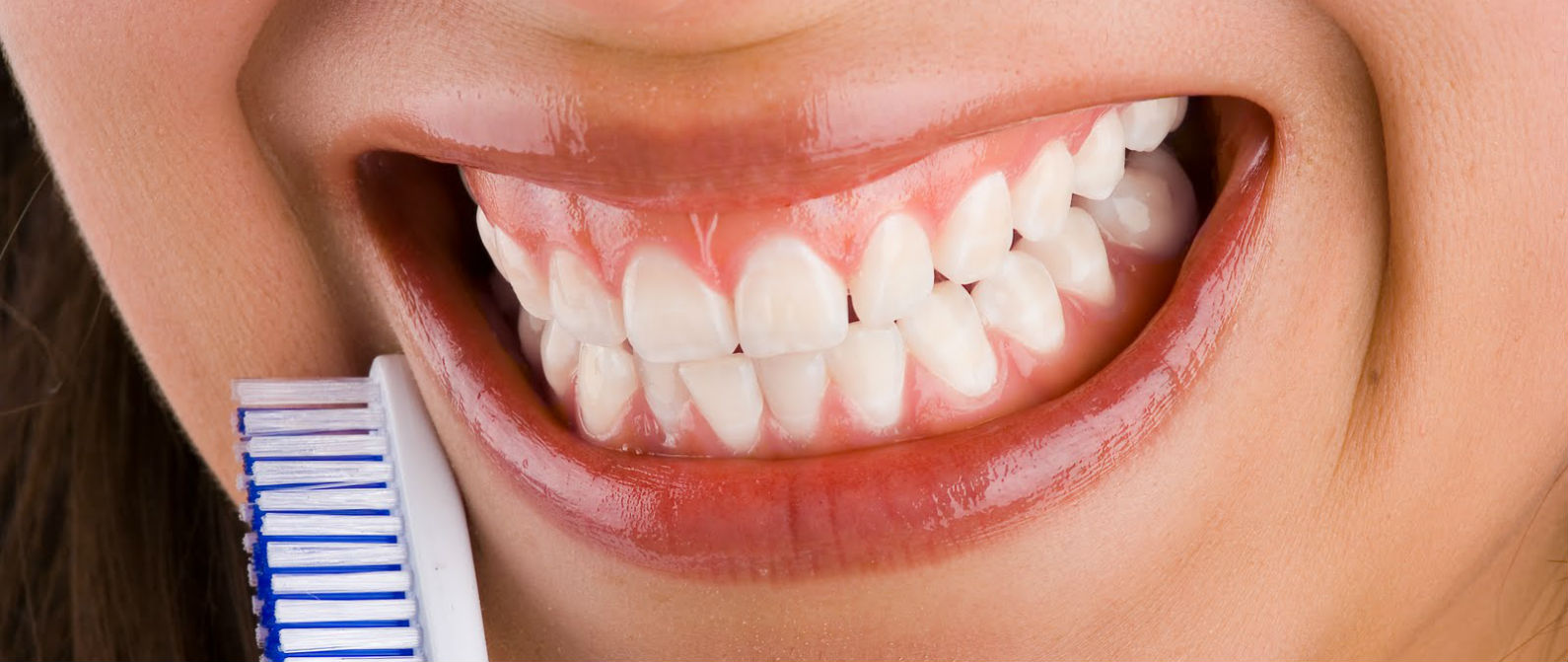 Sangrado de encías, gingivitis