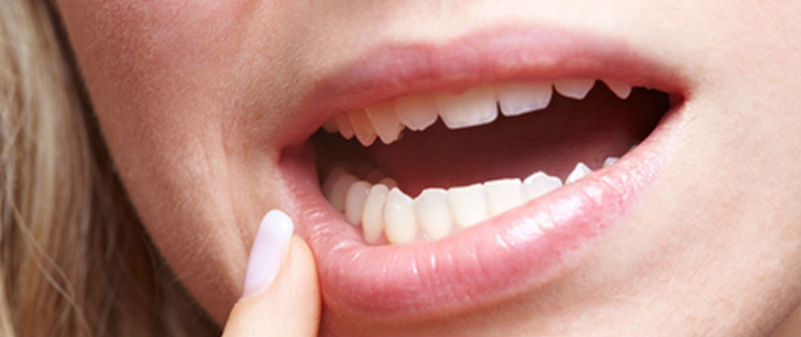 ¿Por qué se mueven los dientes?