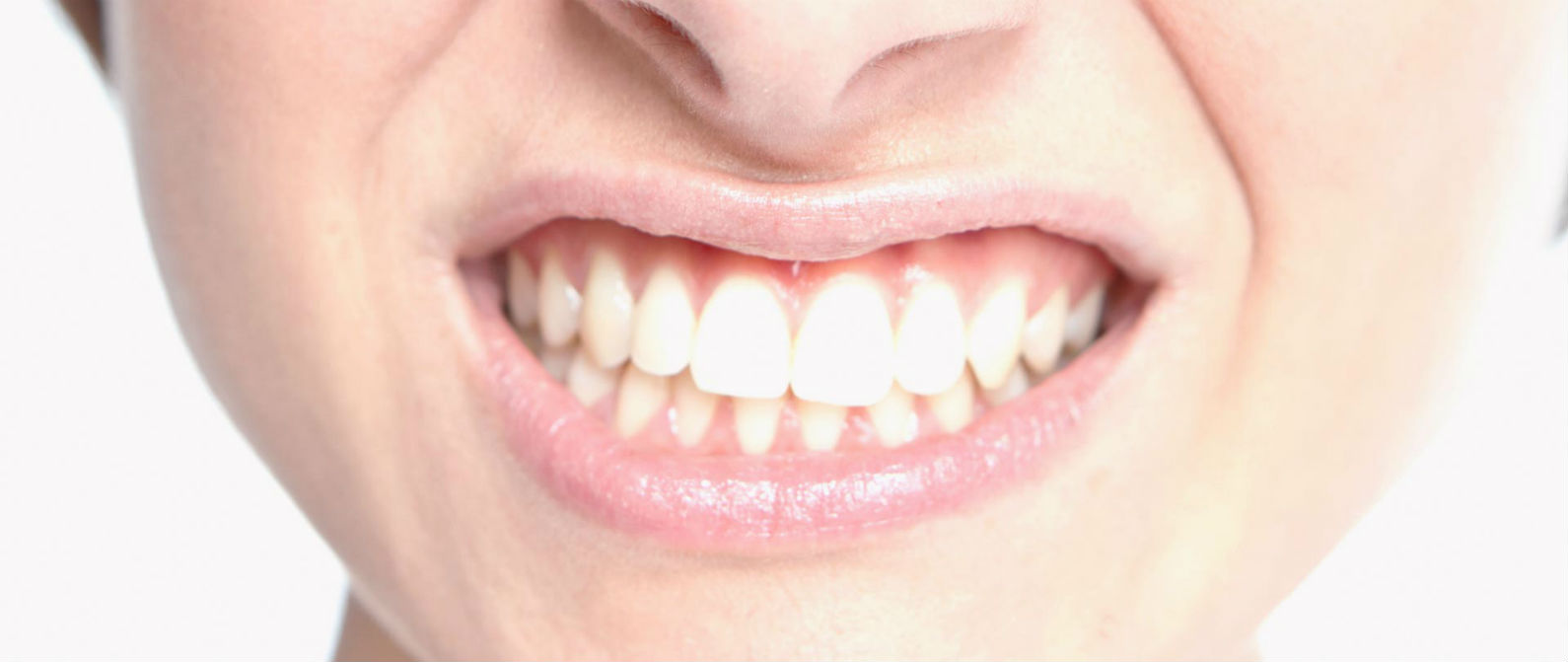 Rechinas los dientes