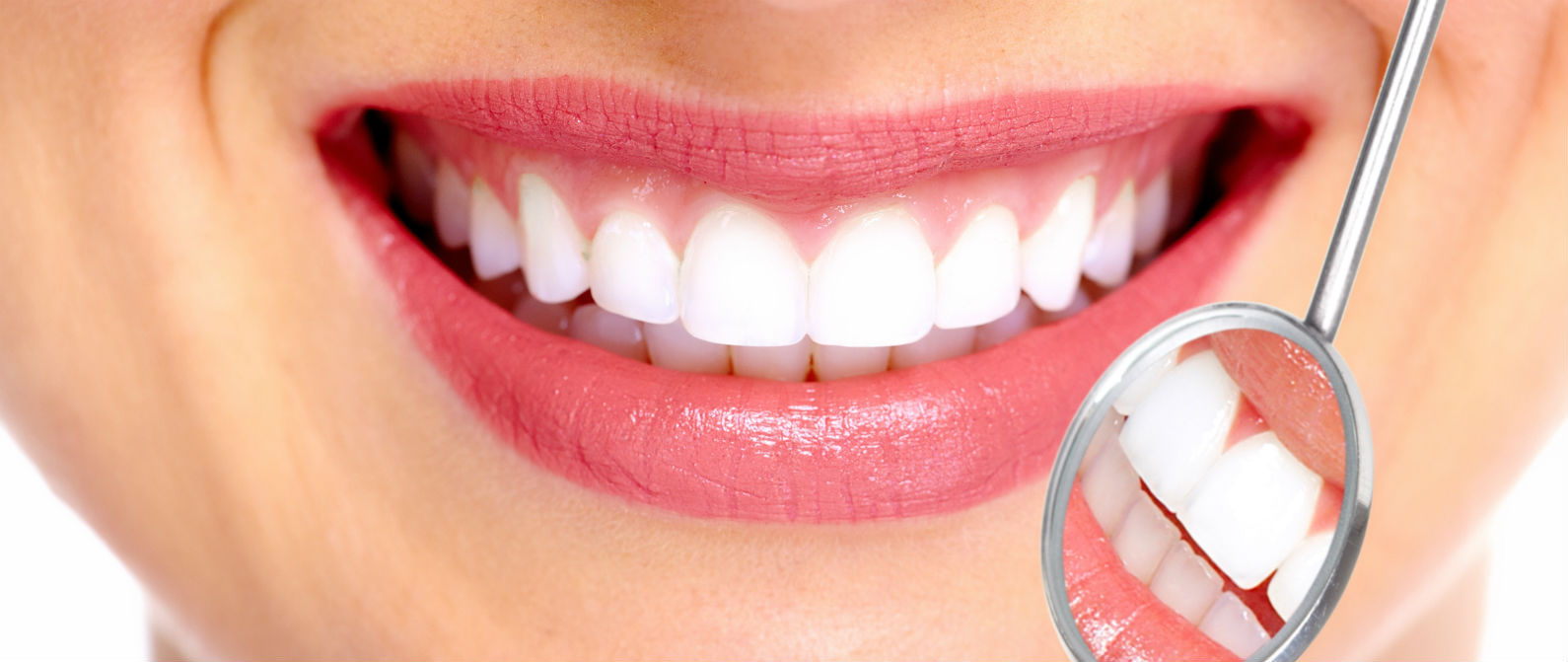 La importancia de la limpieza dental