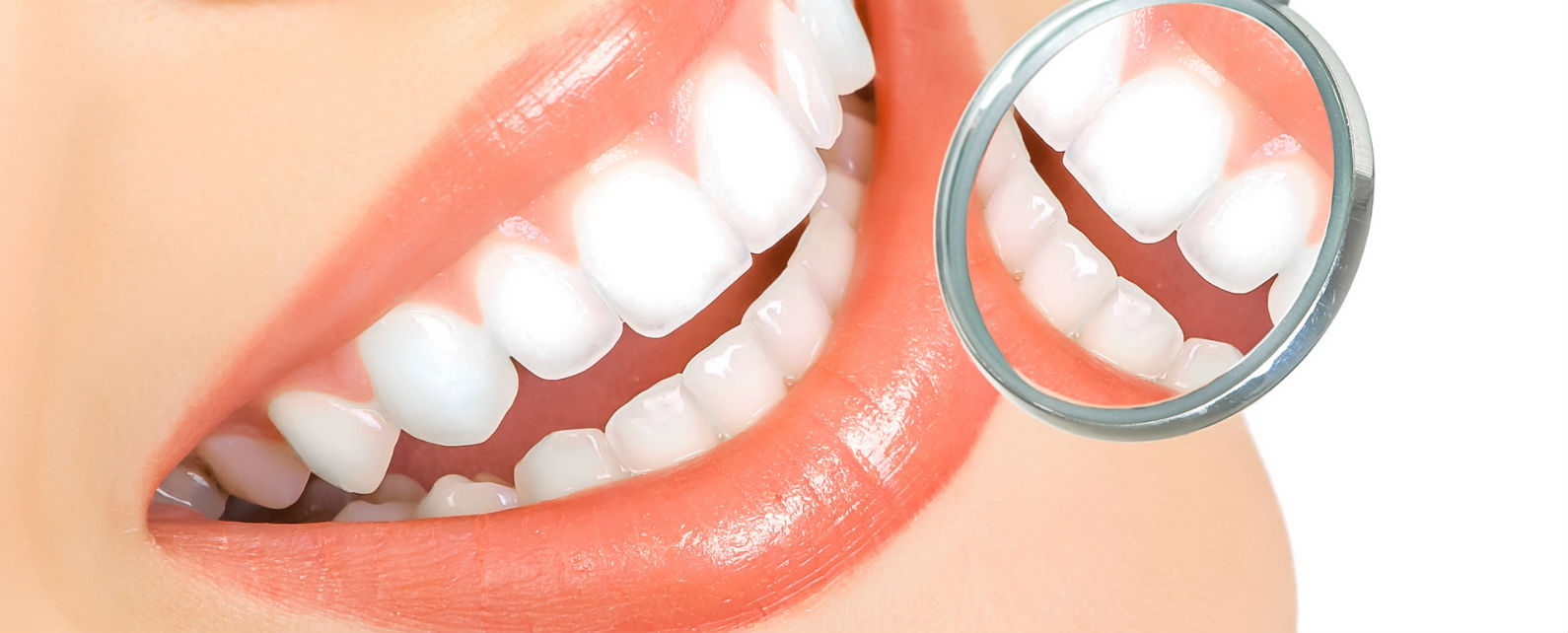 Limpieza dental ultrasónica aprecio especial