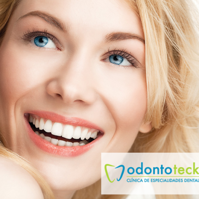 Carillas dentales jpg