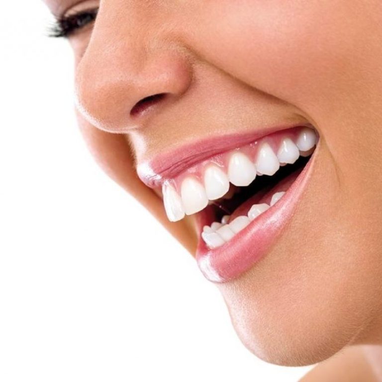 blanqueamiento-dental-palma-de-mallorca-1024x688