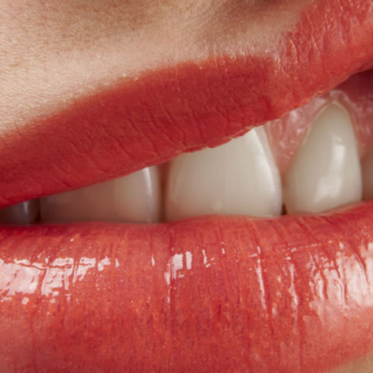 Cómo identificar una encía enferma, odontotecks