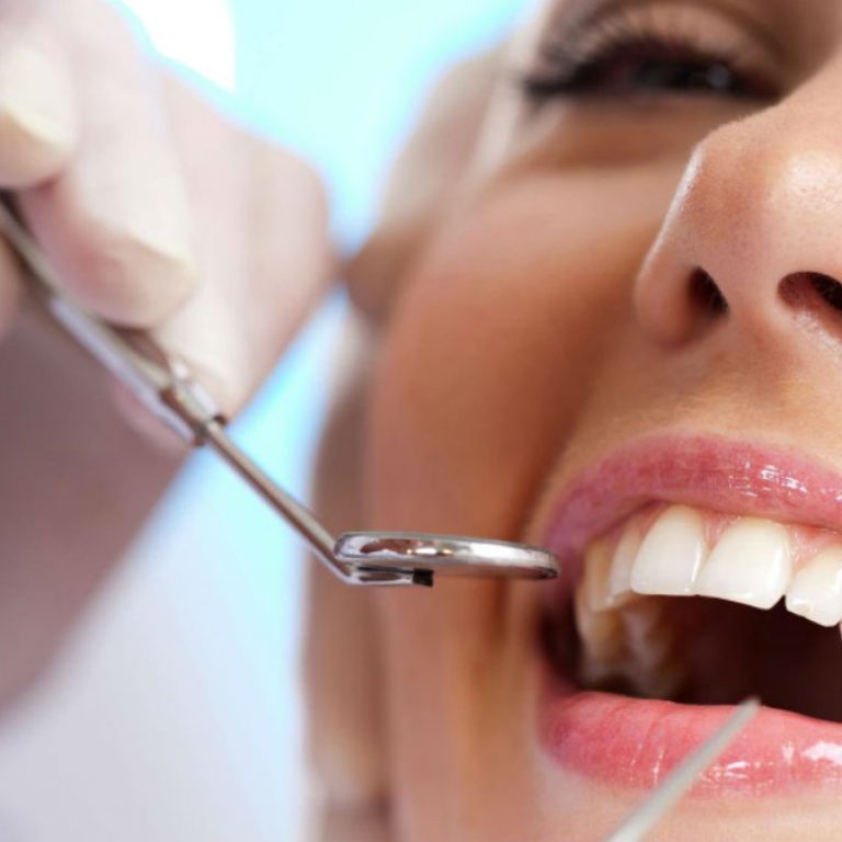 Descuento en limpieza ultrasónica y aeropulido dental