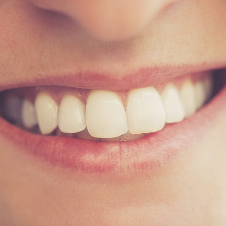 dientes.blancos.blanqueamiento.dental