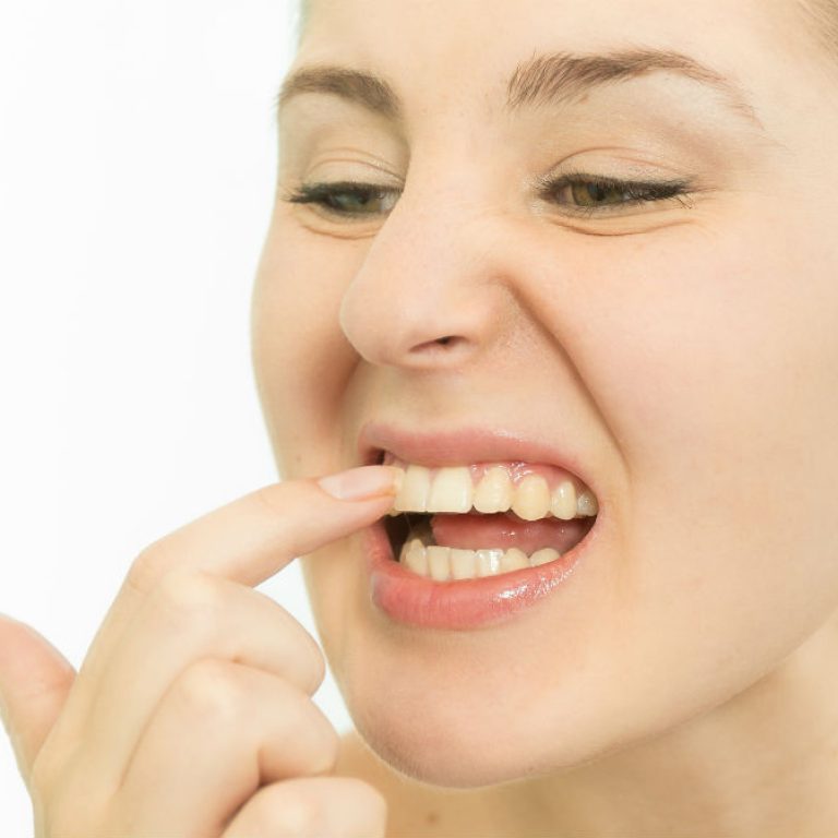 Dolor de encías, te decimos que hacer