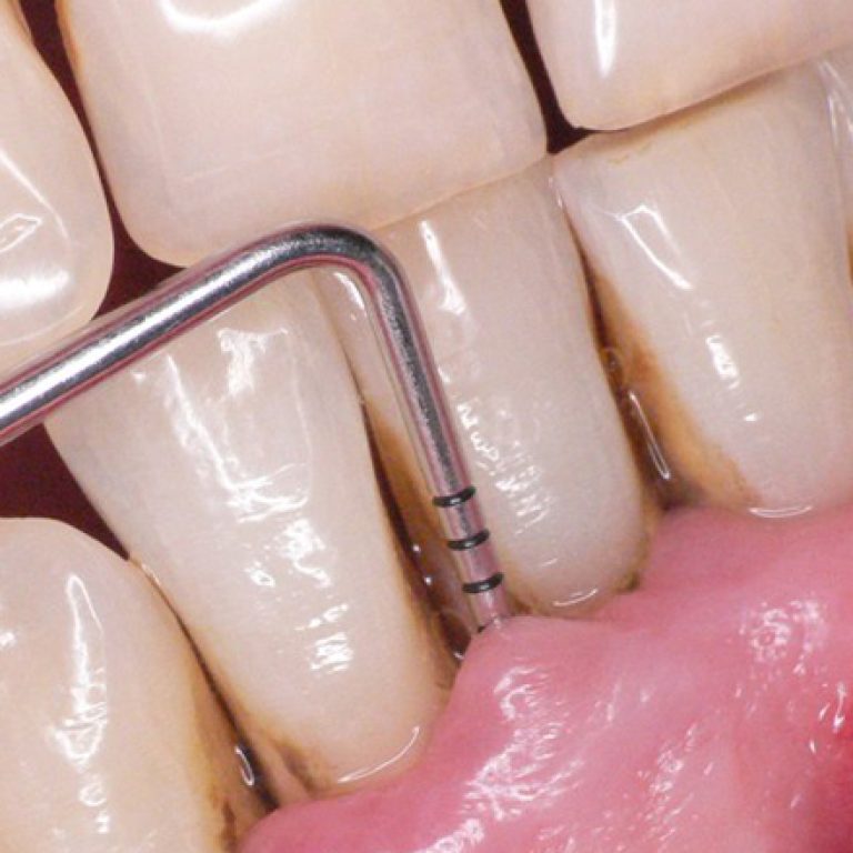 imagen_periodoncia