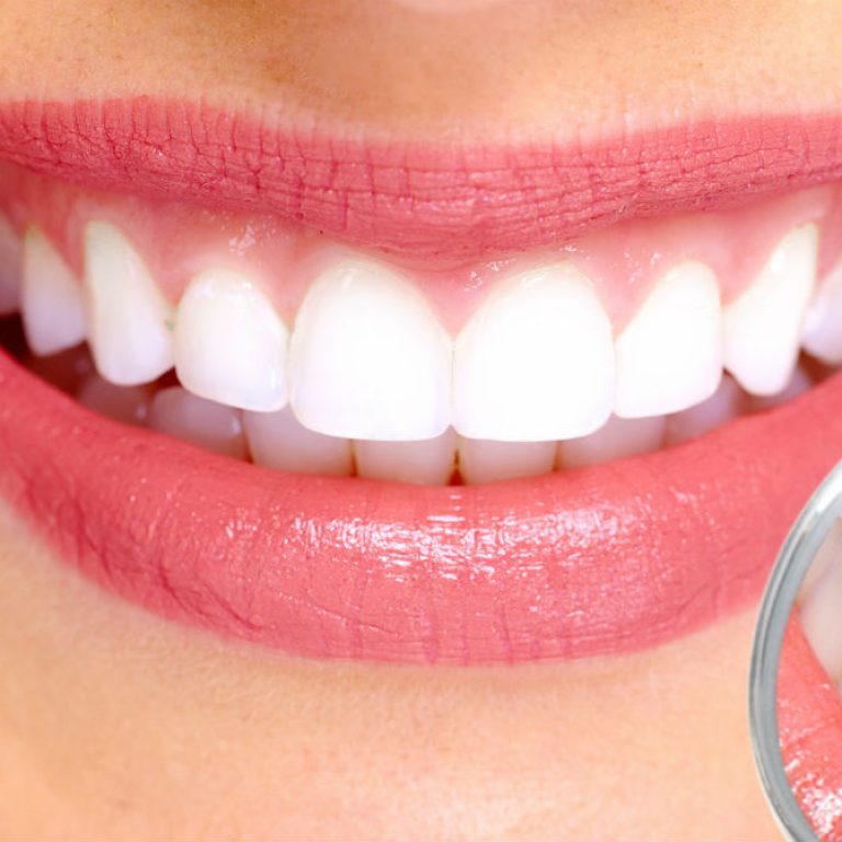 La importancia de la limpieza dental