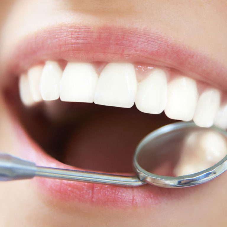 ¿Qué es una limpieza dental ultrasónica?
