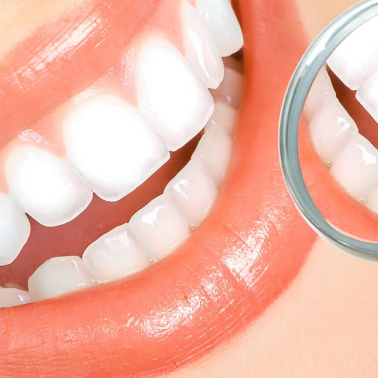 Limpieza dental ultrasónica aprecio especial