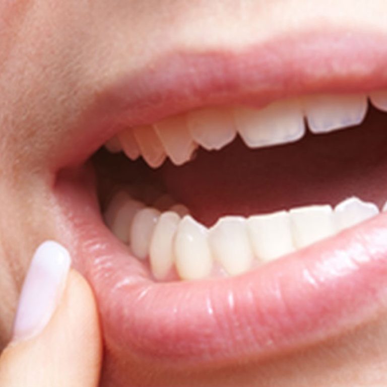 ¿Por qué se mueven los dientes?