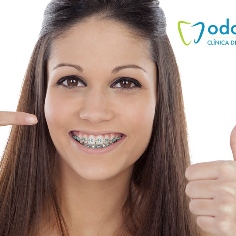 odonto-brackets