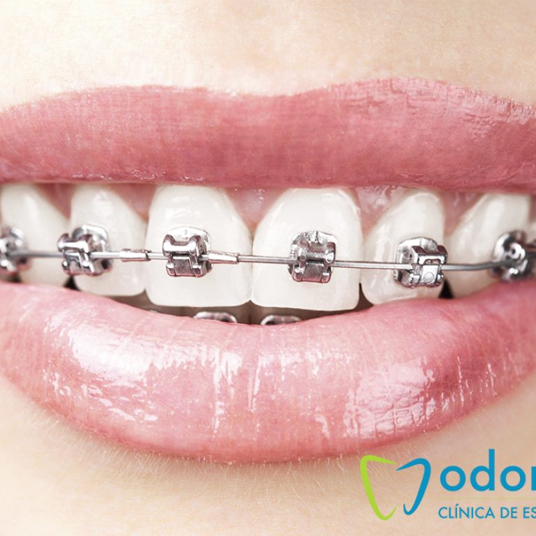 ortodoncia