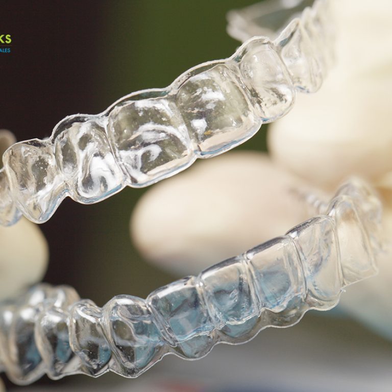 retenedores.dentalesjpg