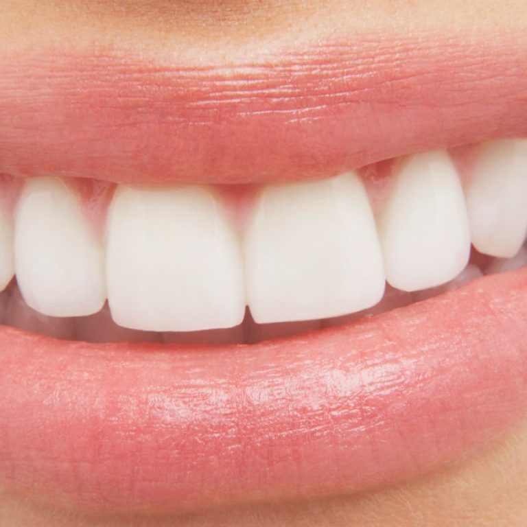 Siete cosas desconocidas de los dientes