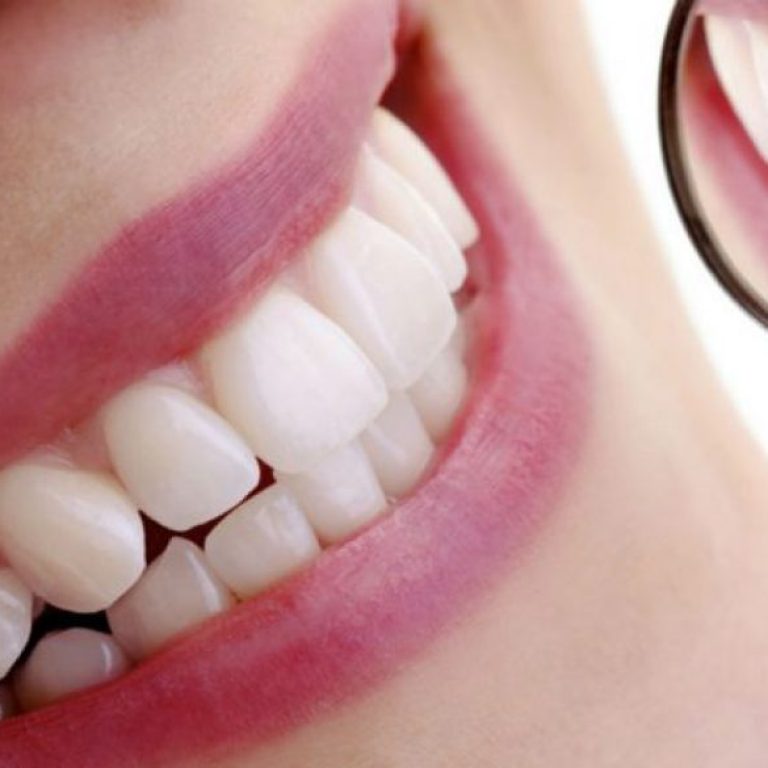 Ventajas de las resinas dentales